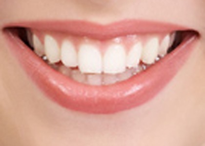 دراسة: انقطاع الطمث يؤثر على صحة الأسنان