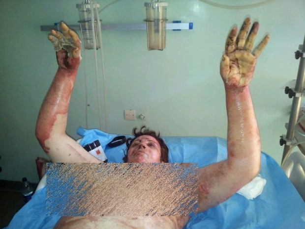 انفجار حمام الزياني في كازا.. الضحية مليكة في العناية المركزة تستغيث وصاحبة الحمام تنكرت (صور)