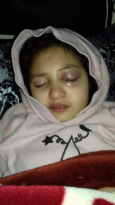 مأساة.. وفاة الطفلة هبة التي عنفتها معلمتها (صور)