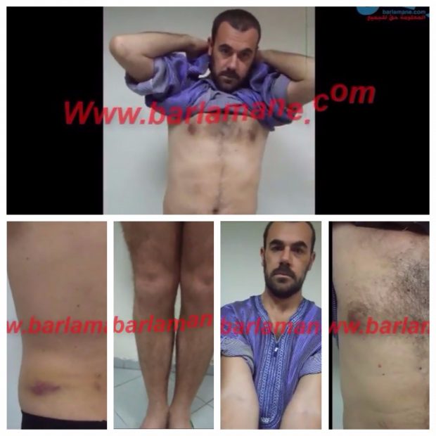 بالفيديو والصور.. الزفزافي يعرض مناطق من جسده لتأكيد عدم تعرضه للتعذيب في السجن