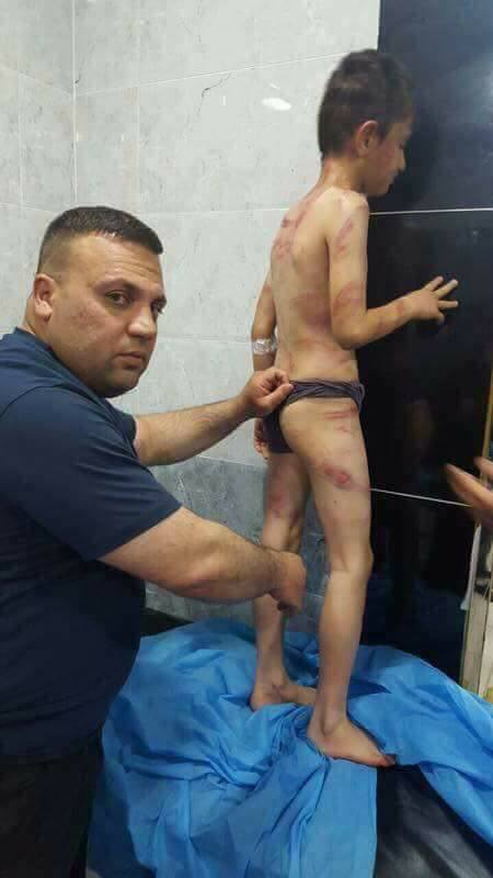 ترويج صورة لطفل عراقي على أنها لمغربي تعرض للتعذيب.. حضيو من كذوب الفايس بوك (صور)