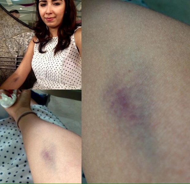 بسبب وجبة في جامع الفنا.. الممثلة سلمى حبيبي في المستعجلات