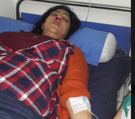 بعد كسر أنفها.. هل تحضر بوطازوت مهرجان الضحك في كازا؟