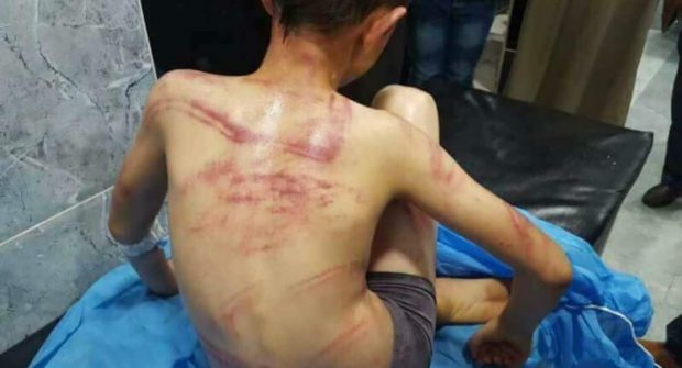 البوليس كيقلّب على موالين الفعلة.. طفل من كركوك العراقية ردّوه مغربي تعرض للتعذيب في إمزورن!