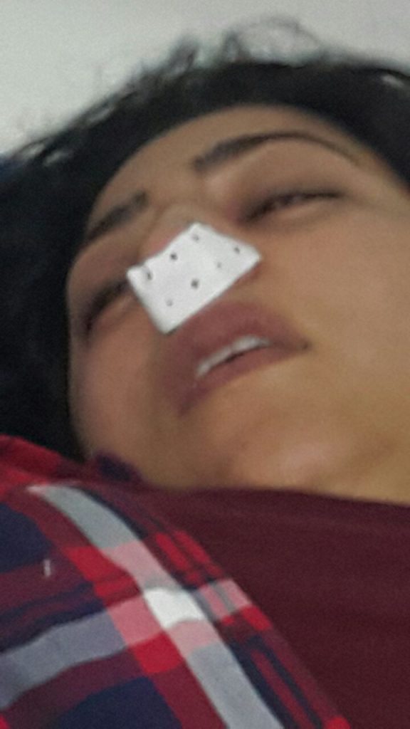 الاعتداء على دنيا بوطازوت.. صور أخرى