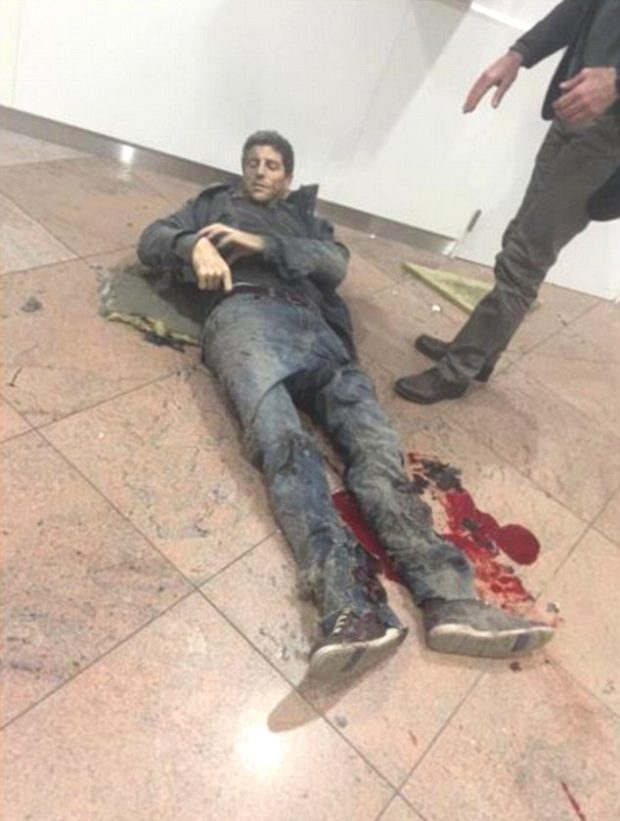قالتها الصورة.. نجم عالمي في كرة السلة يفقد قدمه في تفجير مطار بروكسيل