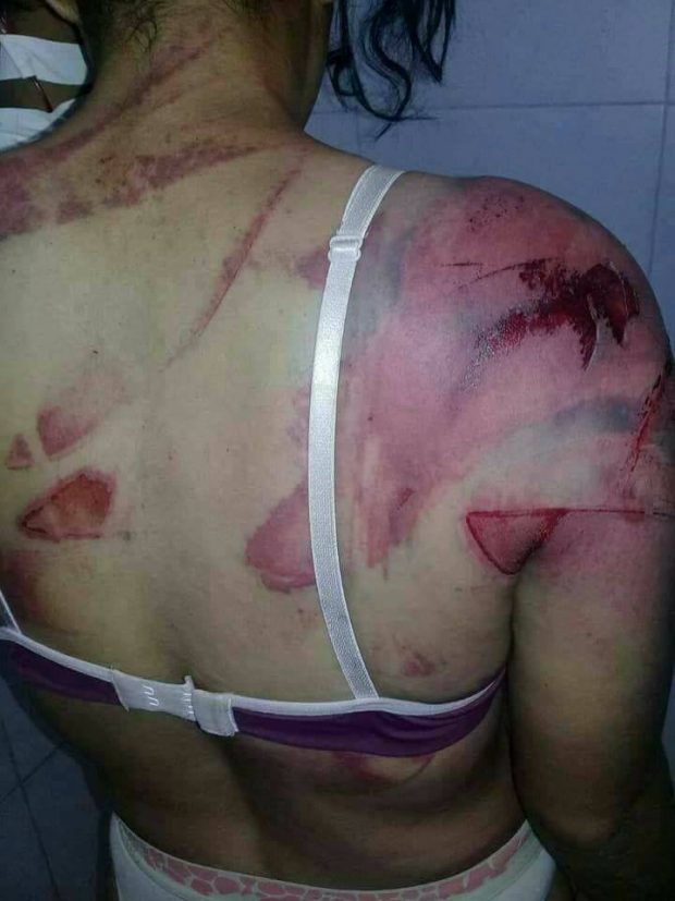 بالصور من تارجيست.. وفاة امرأة عذبها زوجها