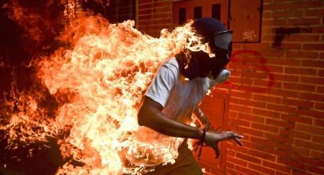 لقطة احتراق محتج.. “أزمة فنزويلا” تفوز بجائزة أفضل صورة صحافية