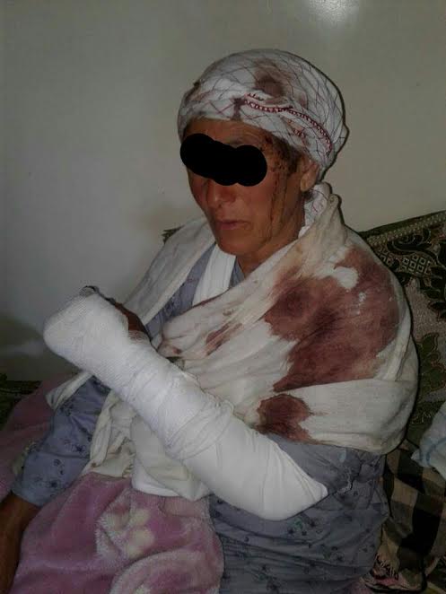 بسبب خلاف بين طفلين.. اعتداء بهراوات وآلات حادة على أسرة! (صور)