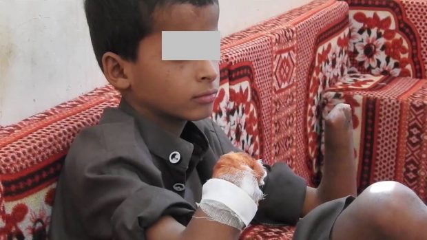 بالفيديو.. ألغام إيران تقتل أطفال اليمن بأيادي الحوثيين!