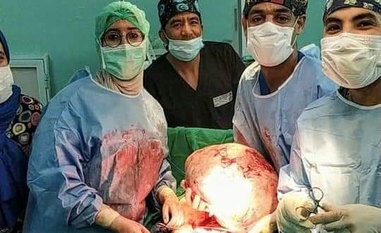 يزن حوالي 15 كيلوغراما.. فريق طبي ينجح في استئصال ورم ضخم من بطن امرأة في الرشيدية (صور)